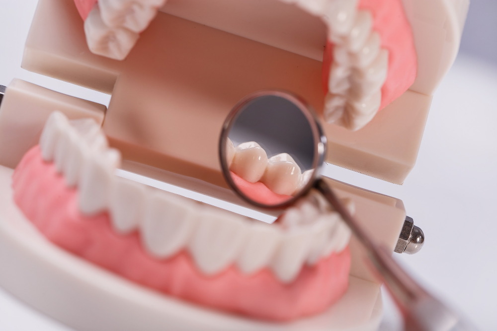Minha prótese dentária está quebrada: O que devo fazer? 2 protese dentaria